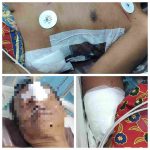 Korban penganiayaan, Muhammad Salmi dan Nor Hikmah, yang dirawat di Rumah Sakit Umum Daerah Kapuas setelah diserang dengan senjata tajam oleh pelaku.