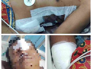 Pasutri di Selat Hulu Alami Luka Parah, Pelaku Masih Buron