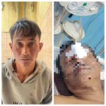 Wahyudi bin Abdul Wahit (42), tersangka penganiayaan dan Muhammad Salmi bin Asnawi (56) dan Nor Hikmah binti Salamat (53), korban penganiayaan